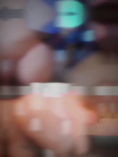 Tracer vs Squirrel Girl | 1v1 Edit/WIS Edit