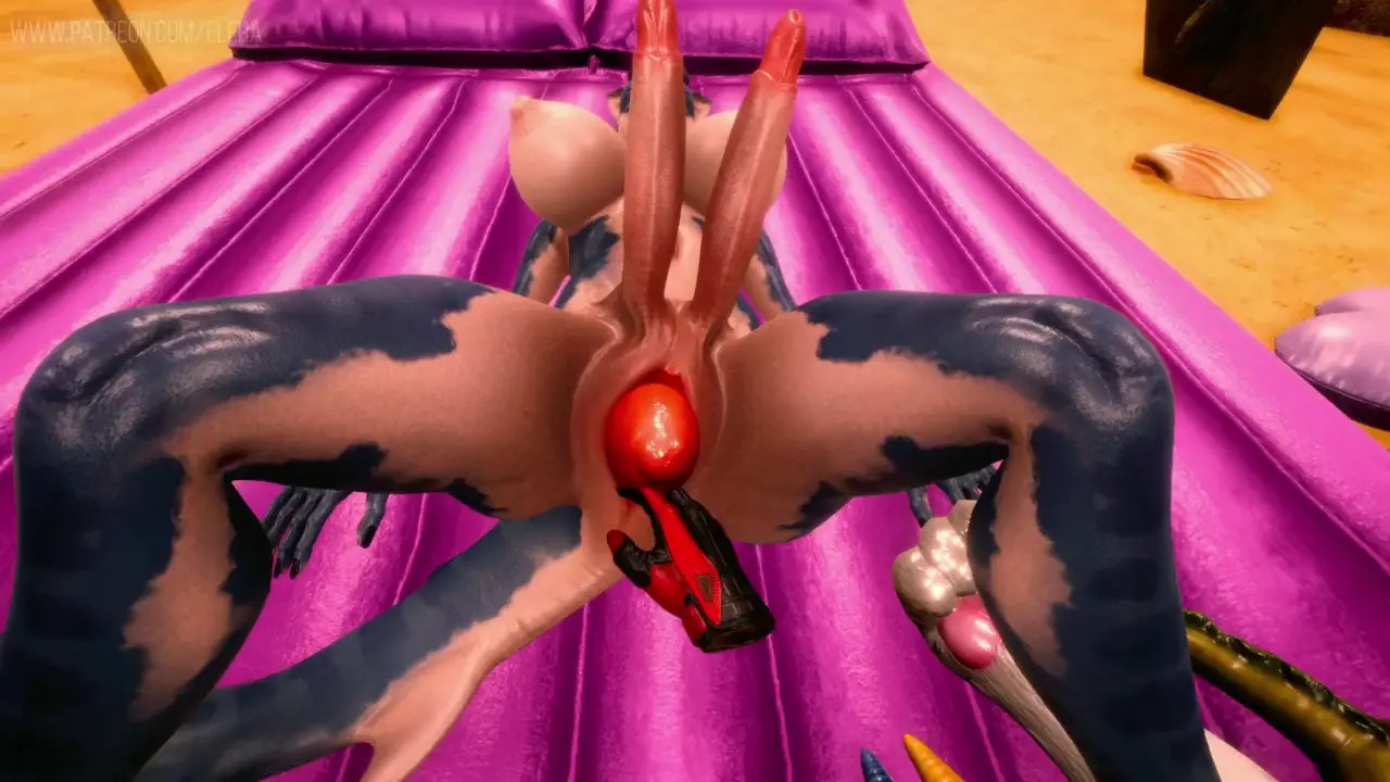 New Uterine Prolapse Feature