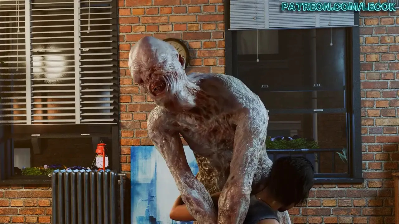 Valentine - Breast Augmentation