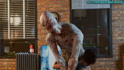 Valentine - Breast Augmentation