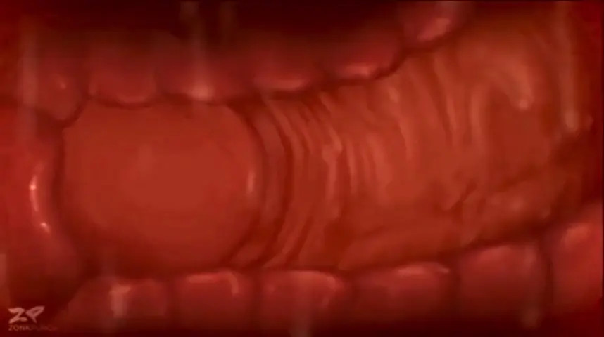Pussy X-Ray (No Moaning, Flesh Sounds)